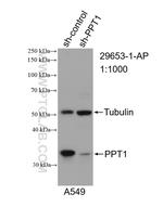 PPT1 Antibody in Western Blot (WB)