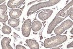 DIS3 Antibody in Immunohistochemistry (Paraffin) (IHC (P))