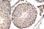 DIS3 Antibody in Immunohistochemistry (Paraffin) (IHC (P))