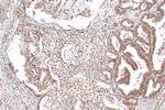 DIS3 Antibody in Immunohistochemistry (Paraffin) (IHC (P))