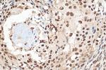 DIS3 Antibody in Immunohistochemistry (Paraffin) (IHC (P))