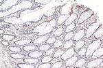 DIS3 Antibody in Immunohistochemistry (Paraffin) (IHC (P))