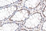 DIS3 Antibody in Immunohistochemistry (Paraffin) (IHC (P))