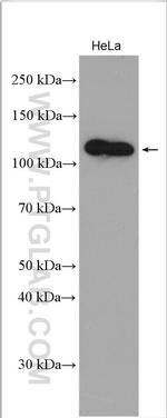 DIS3 Antibody in Western Blot (WB)