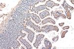 HTR3A Antibody in Immunohistochemistry (Paraffin) (IHC (P))