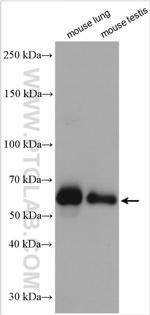 HTR3A Antibody in Western Blot (WB)