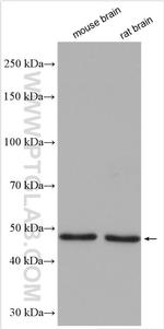 Cannabinoid receptor 1 Antibody in Western Blot (WB)