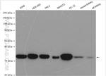 STUB1 Antibody in Western Blot (WB)