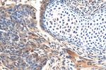 SHH Antibody in Immunohistochemistry (Paraffin) (IHC (P))