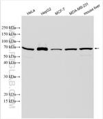 SHH Antibody in Western Blot (WB)