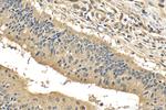 FMNL3 Antibody in Immunohistochemistry (Paraffin) (IHC (P))