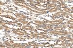 DYNC2H1 Antibody in Immunohistochemistry (Paraffin) (IHC (P))