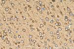 ERLEC1 Antibody in Immunohistochemistry (Paraffin) (IHC (P))