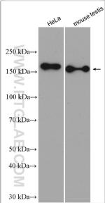 RPGRIP1L Antibody in Western Blot (WB)