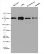 RPGRIP1L Antibody in Western Blot (WB)