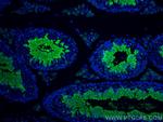 MGC33407/ACTL9 Antibody in Immunohistochemistry (Paraffin) (IHC (P))