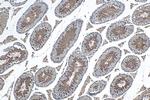 MGC33407/ACTL9 Antibody in Immunohistochemistry (Paraffin) (IHC (P))