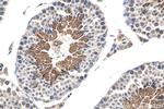 MGC33407/ACTL9 Antibody in Immunohistochemistry (Paraffin) (IHC (P))