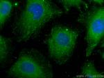 PFKFB4 Antibody in Immunocytochemistry (ICC/IF)