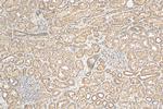 PFKFB4 Antibody in Immunohistochemistry (Paraffin) (IHC (P))