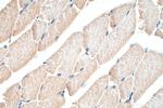 Hamartin/TSC1 Antibody in Immunohistochemistry (Paraffin) (IHC (P))