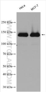 Hamartin/TSC1 Antibody in Western Blot (WB)