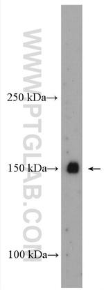 Hamartin/TSC1 Antibody in Western Blot (WB)