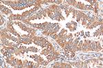 Kindlin 2 Antibody in Immunohistochemistry (Paraffin) (IHC (P))