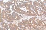 EIF2B5 Antibody in Immunohistochemistry (Paraffin) (IHC (P))