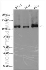 GAA Antibody in Western Blot (WB)