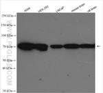 IDUA Antibody in Western Blot (WB)