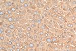 GPC3 Antibody in Immunohistochemistry (Paraffin) (IHC (P))