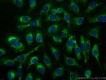 HIP14/ZDHHC17 Antibody in Immunocytochemistry (ICC/IF)