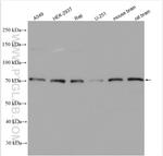 HIP14/ZDHHC17 Antibody in Western Blot (WB)