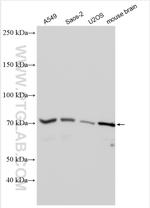 HIP14/ZDHHC17 Antibody in Western Blot (WB)