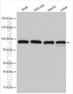 P85a/PIK3R1 Antibody in Western Blot (WB)