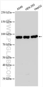 P85a/PIK3R1 Antibody in Western Blot (WB)