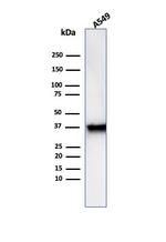 Annexin A1/(Hairy Cell Leukemia Marker) Antibody in Western Blot (WB)