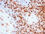 Annexin A1/ (Hairy Cell Leukemia Marker) Antibody in Immunohistochemistry (Paraffin) (IHC (P))