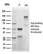 Annexin A1/ (Hairy Cell Leukemia Marker) Antibody in SDS-PAGE (SDS-PAGE)