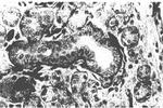 FGF Receptor 1 Antibody in Immunohistochemistry (Paraffin) (IHC (P))