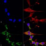 Fibroblast Growth Factor 13 (FGF13) Antibody in Immunocytochemistry (ICC/IF)