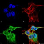 Fibroblast Growth Factor 13 (FGF13) Antibody in Immunocytochemistry (ICC/IF)