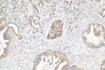 PLCD4 Antibody in Immunohistochemistry (Paraffin) (IHC (P))