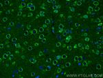 ADCY5 Antibody in Immunohistochemistry (PFA fixed) (IHC (PFA))