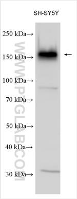 ADCY8 Antibody in Western Blot (WB)