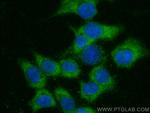 PACS2 Antibody in Immunocytochemistry (ICC/IF)