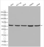 DDB2 Antibody in Western Blot (WB)