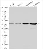 DDB2 Antibody in Western Blot (WB)