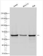 RASGRP2 Antibody in Western Blot (WB)